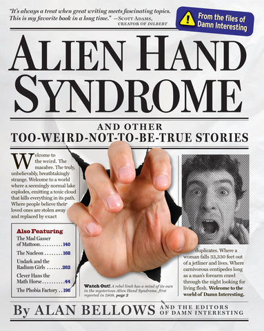 Alien Hand Syndrome